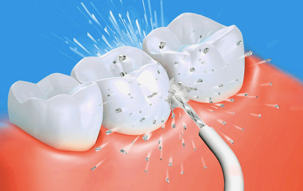 протезирование зубов в ялте