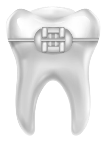 Зуб с брекетом