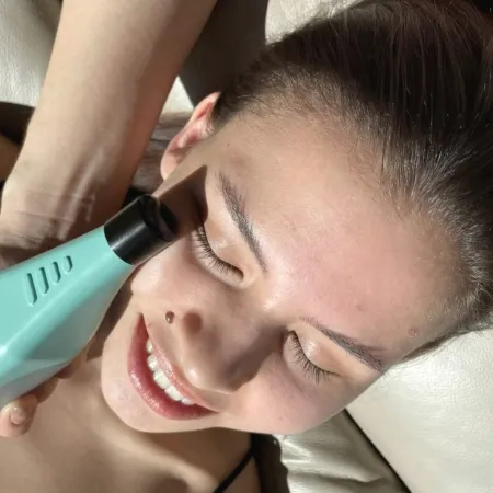 Аппаратное омоложение в Тюмени