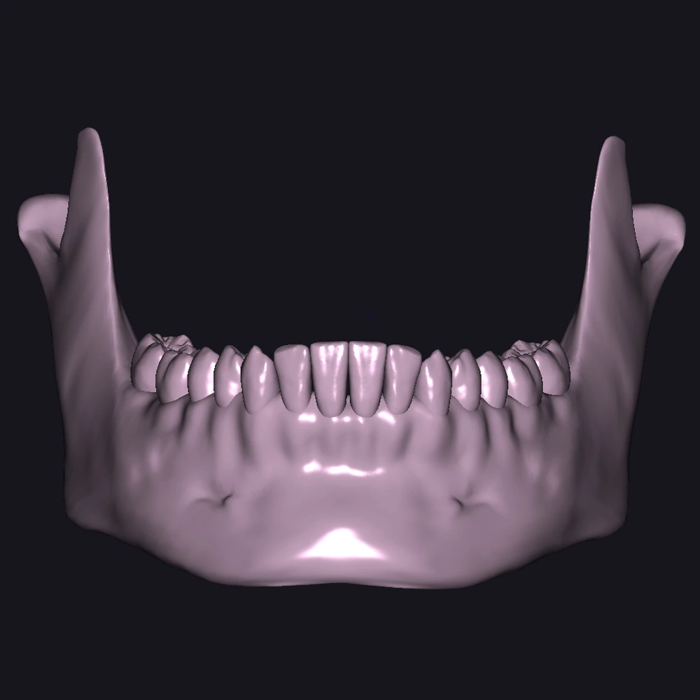 STL jaw Exocad