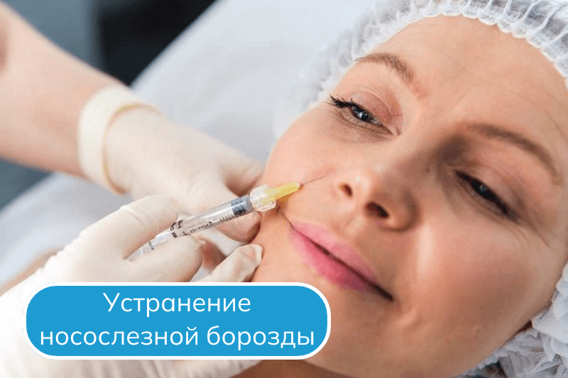 Коррекция носослезной борозды в Сочи