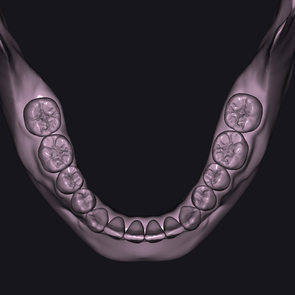 STL jaw Exocad