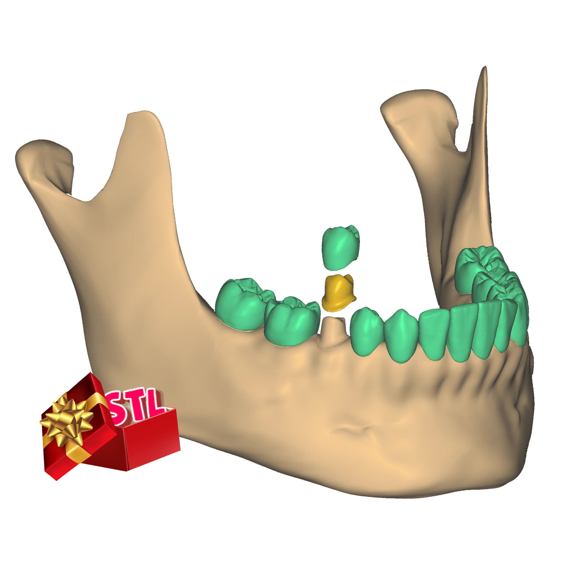 STL jaw Exocad