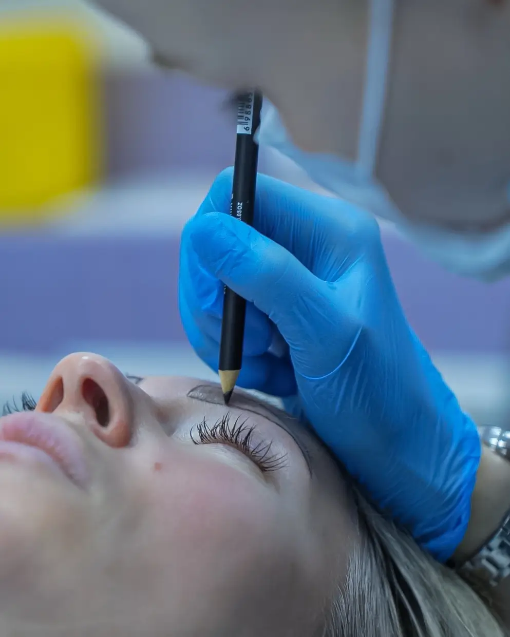  ПЕРЕСАДКА ВОЛОС БРОВЕЙ МЕТОДОМ FUE 