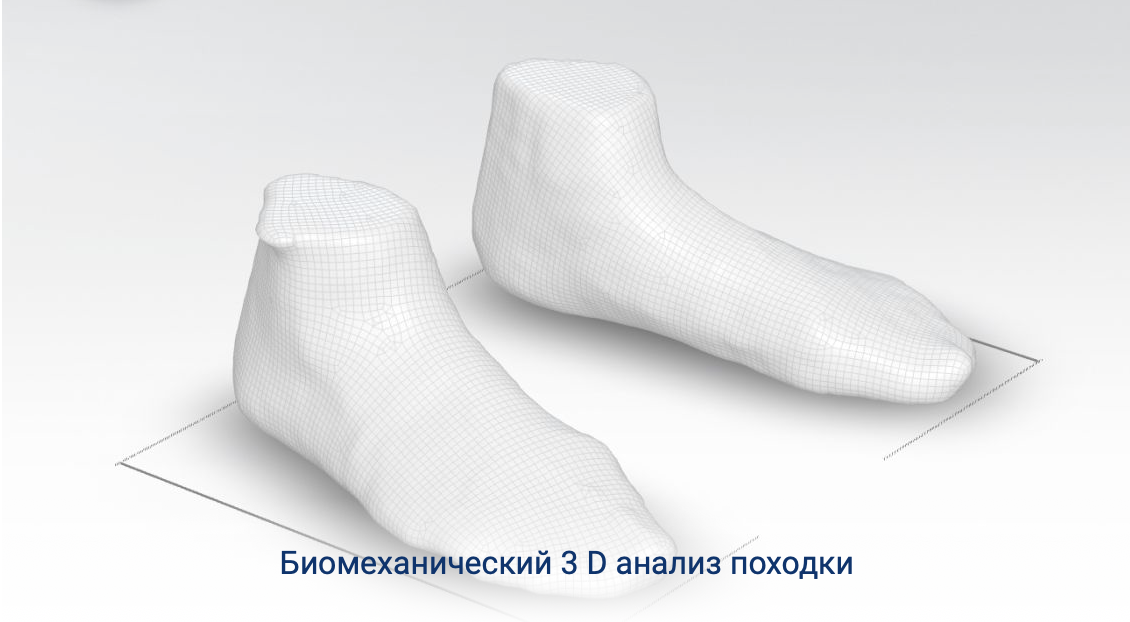 биомеханические 3d анализ походки