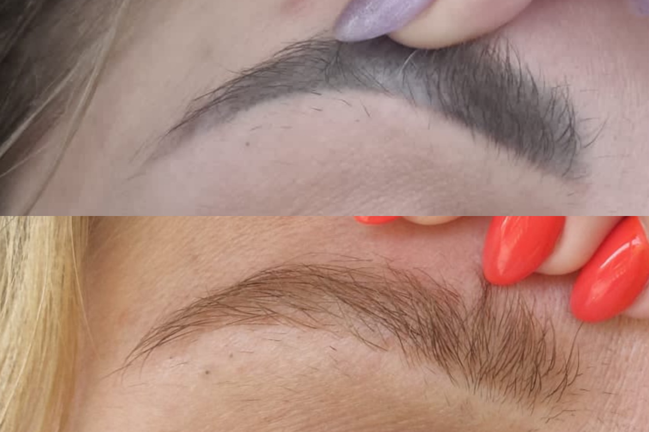 удалить татуаж москва удалить перманентный макияж москва