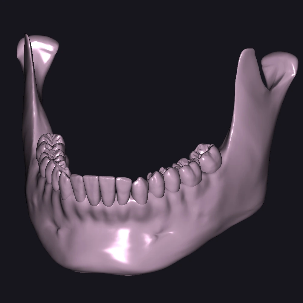 STL jaw Exocad