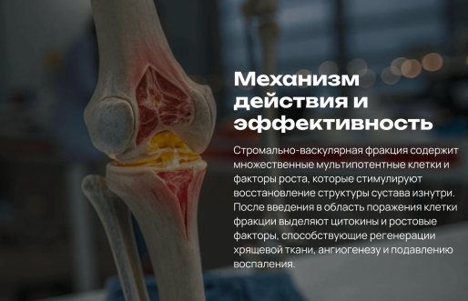 лечение артроза в Воронеже