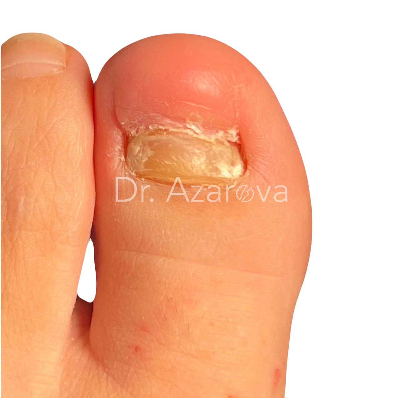 хирург подолог в Москве