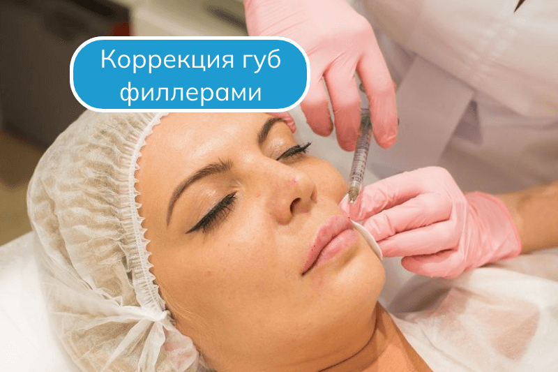 Коррекция губ филлерами в Сочи