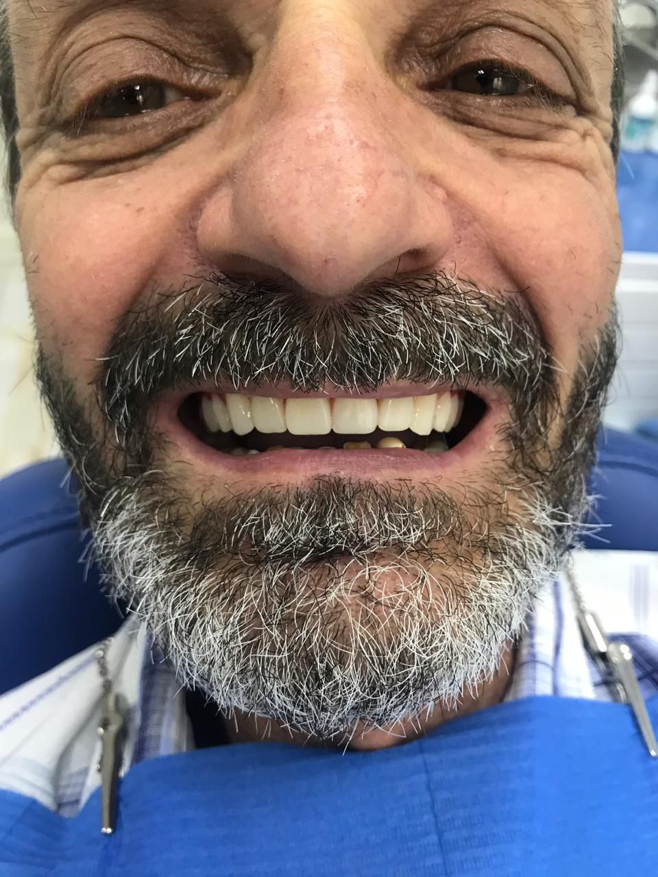 Участникам СВО скидка 20% 