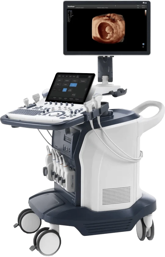 Ультразвуковой аппарат Sonoscape S60 с изображением 3D-сканирования Медицинский УЗИ-аппарат Sonoscape S60, оснащённый монитором и современным интерфейсом